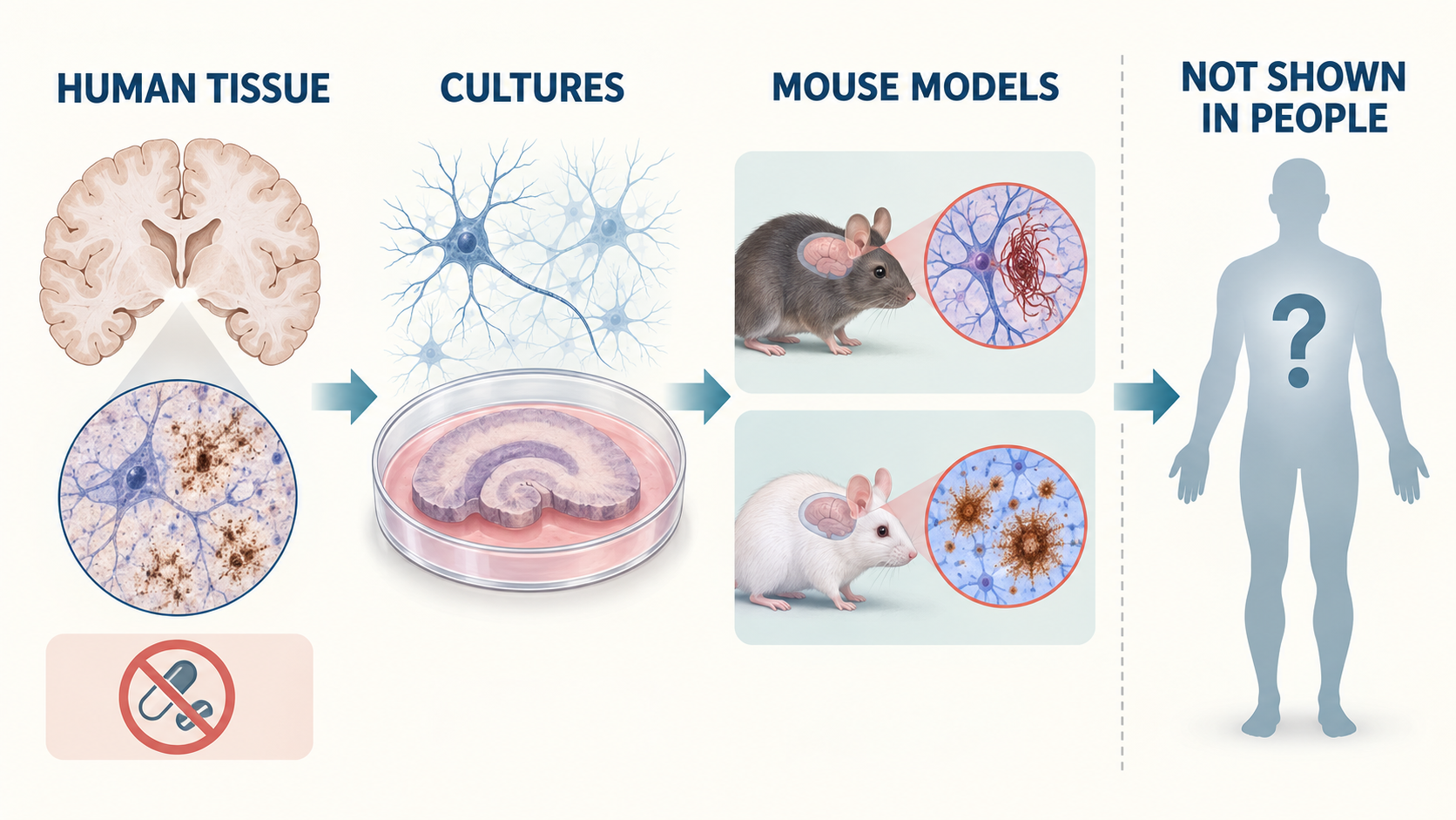Evidence ladder moving from sampled human brain tissue to cultures and two mouse models, with human treatment benefit marked as not yet shown